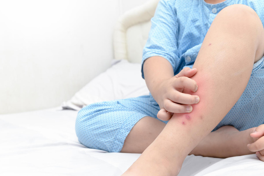 1688781363_knee.jpg